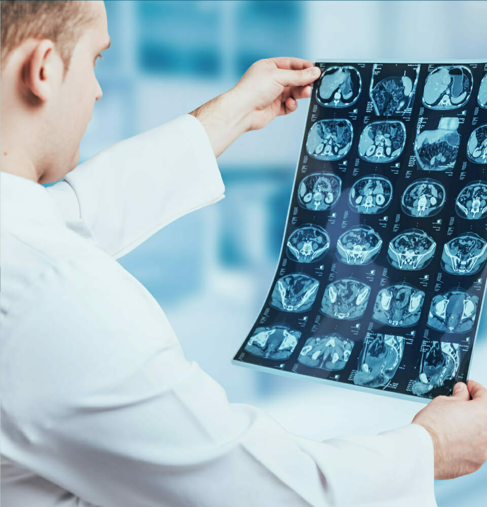 Demystifying MRI Scans: A Comprehensive Guide to How They Work