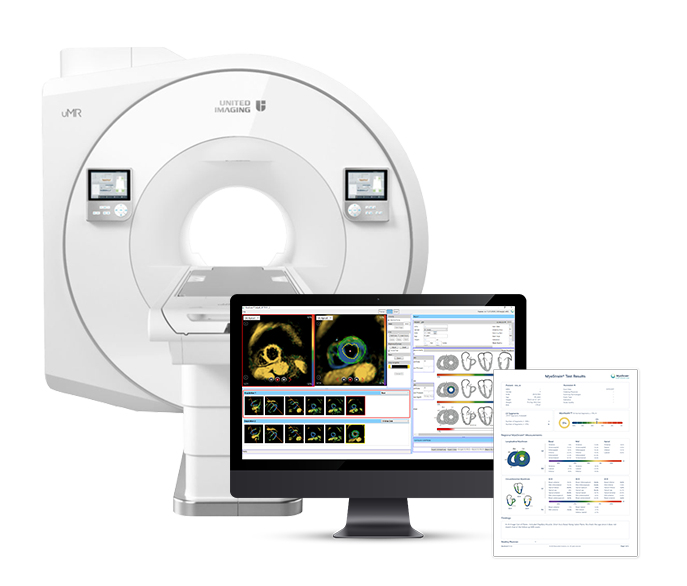 611278a3e9ea986c9937165b_myostrain mri-report
