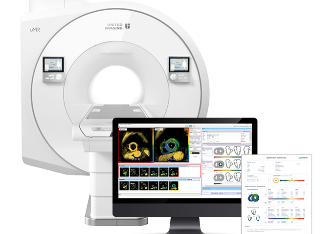 611278a3e9ea986c9937165b_myostrain mri-report